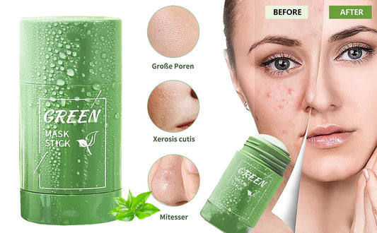 THE MAGIC GREEN STICK MASK | Blackhead Mud Mask | Deep Cleansing Mask | To Tight Pores | For Acne